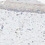 Attractin Polyclonal Antibody