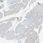 Attractin Antibody in Immunohistochemistry (Paraffin) (IHC (P))