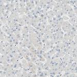 MUC1 Antibody in Immunohistochemistry (Paraffin) (IHC (P))