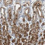 MUC1 Antibody in Immunohistochemistry (Paraffin) (IHC (P))