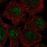 SGK2 Polyclonal Antibody