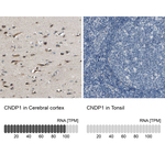 CNDP1 Polyclonal Antibody