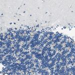 M-cadherin Antibody in Immunohistochemistry (Paraffin) (IHC (P))