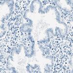 M-cadherin Antibody in Immunohistochemistry (Paraffin) (IHC (P))