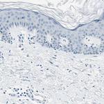 M-cadherin Antibody in Immunohistochemistry (Paraffin) (IHC (P))