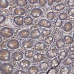 CEP104 Polyclonal Antibody