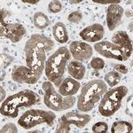 ETNK1 Antibody in Immunohistochemistry (Paraffin) (IHC (P))