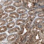 ETNK1 Polyclonal Antibody