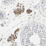 ETNK1 Antibody in Immunohistochemistry (Paraffin) (IHC (P))
