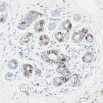 CD166 Antibody in Immunohistochemistry (Paraffin) (IHC (P))
