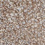 CD166 Antibody in Immunohistochemistry (Paraffin) (IHC (P))