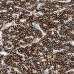 CD166 Antibody in Immunohistochemistry (Paraffin) (IHC (P))