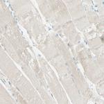 CD166 Antibody in Immunohistochemistry (Paraffin) (IHC (P))