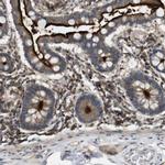 KSR1 Polyclonal Antibody