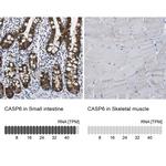 Caspase 6 Polyclonal Antibody