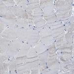Caspase 6 Antibody in Immunohistochemistry (Paraffin) (IHC (P))