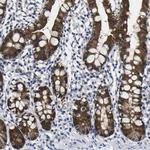Caspase 6 Antibody in Immunohistochemistry (Paraffin) (IHC (P))