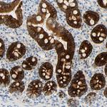 PIGR Antibody in Immunohistochemistry (Paraffin) (IHC (P))