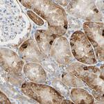 PIGR Antibody in Immunohistochemistry (Paraffin) (IHC (P))