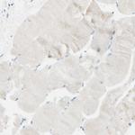 PIGR Antibody in Immunohistochemistry (Paraffin) (IHC (P))