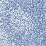 PIGR Antibody in Immunohistochemistry (Paraffin) (IHC (P))