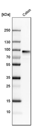 PIGR Antibody in Western Blot (WB)