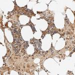 TNK1 Polyclonal Antibody