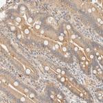 TNK1 Antibody in Immunohistochemistry (Paraffin) (IHC (P))