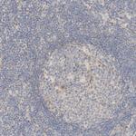 TNK1 Antibody in Immunohistochemistry (Paraffin) (IHC (P))