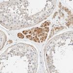 TNK1 Antibody in Immunohistochemistry (Paraffin) (IHC (P))