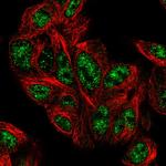 PHYHD1 Polyclonal Antibody