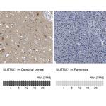 SLITRK1 Antibody in Immunohistochemistry (Paraffin) (IHC (P))