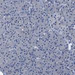 SLITRK1 Antibody in Immunohistochemistry (Paraffin) (IHC (P))