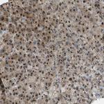 QSOX2 Antibody in Immunohistochemistry (Paraffin) (IHC (P))