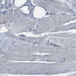 QSOX2 Antibody in Immunohistochemistry (Paraffin) (IHC (P))