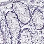 IGSF1 Antibody in Immunohistochemistry (Paraffin) (IHC (P))