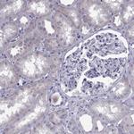 IGSF1 Antibody in Immunohistochemistry (Paraffin) (IHC (P))