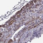 IGSF1 Antibody in Immunohistochemistry (Paraffin) (IHC (P))