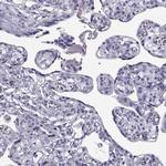 IGSF1 Antibody in Immunohistochemistry (Paraffin) (IHC (P))