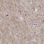 Dopamine Transporter Polyclonal Antibody