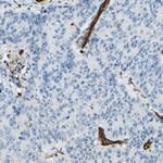 TEM7 Antibody in Immunohistochemistry (Paraffin) (IHC (P))
