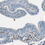 TEM7 Antibody in Immunohistochemistry (Paraffin) (IHC (P))