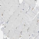 TEM7 Antibody in Immunohistochemistry (Paraffin) (IHC (P))