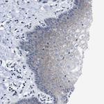 SEMA4B Antibody in Immunohistochemistry (Paraffin) (IHC (P))