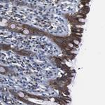 SEMA4B Antibody in Immunohistochemistry (Paraffin) (IHC (P))