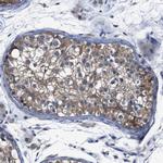 SEMA4B Antibody in Immunohistochemistry (Paraffin) (IHC (P))