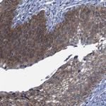 SEMA4B Polyclonal Antibody