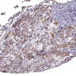 GnRHR Polyclonal Antibody