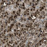 GNS Polyclonal Antibody
