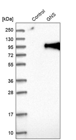 GNS Antibody in Western Blot (WB)